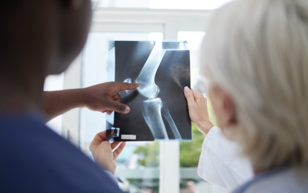 Two health care practitioners, one of which is a physiotherapist, looking at a knee xray